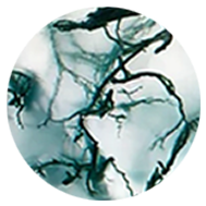 Moss Agate
